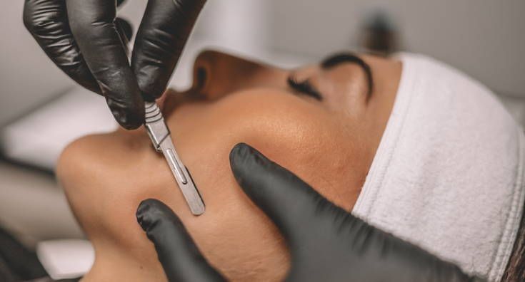 Procedimento de Dermaplaning em Praia Seca